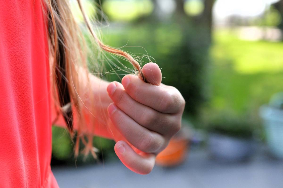 Breaking the Silence: A Lifestyle-Based Approach to Female Hair Loss in Singapore