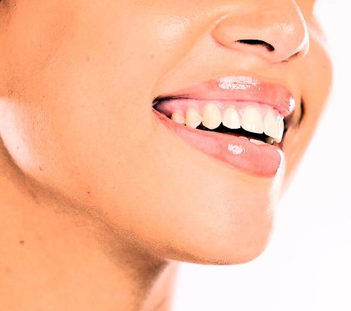Great Smiles for the Whole Family: Finding the Right Dentist in Orchard